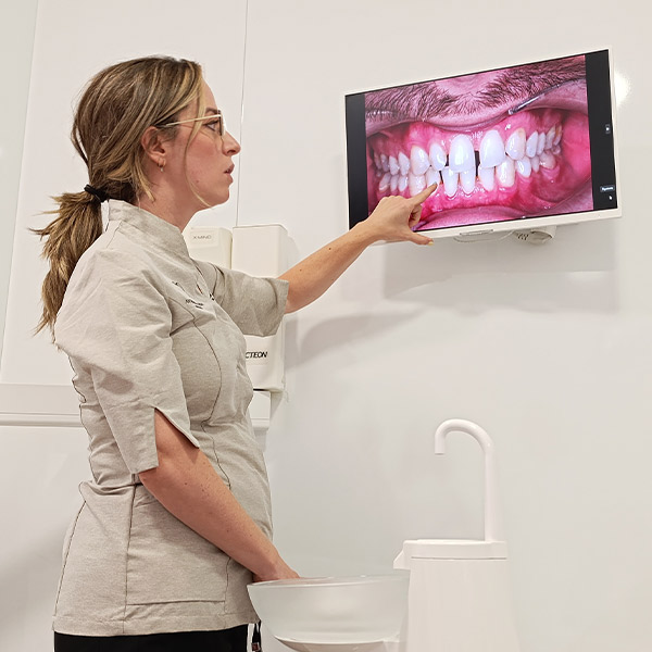 tratamiento Endodoncia en la clínica